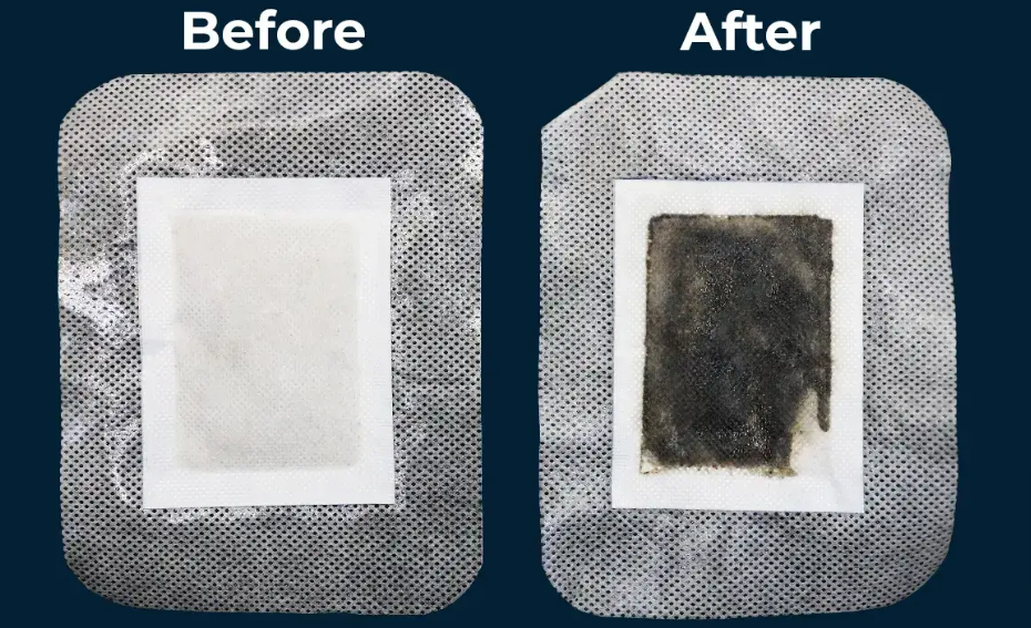 Xitox Foot Pads Before and after